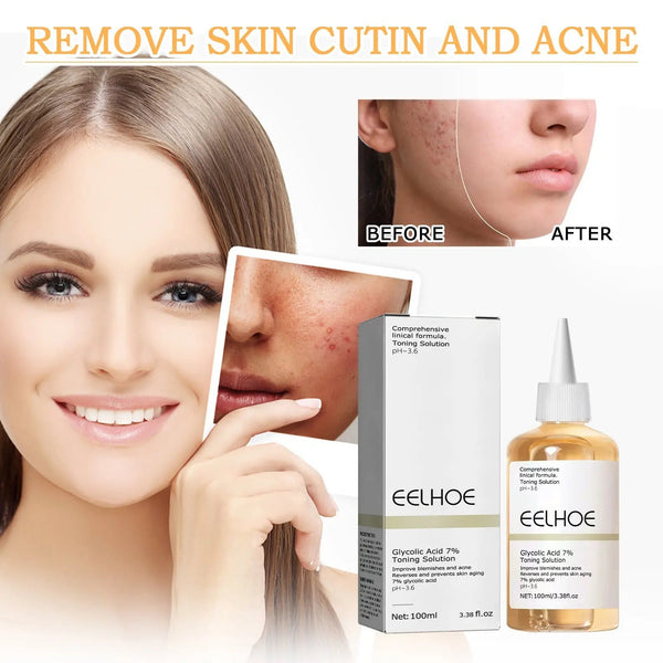 Glycolic Acid 7 Lotion Acne Removing Closed Mouth LUXOREE